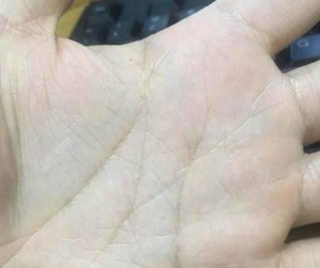 揭秘死亡前兆的隐藏密码