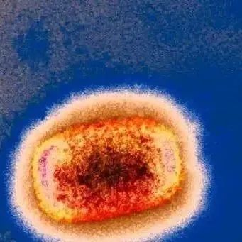多国报告猴痘病例，会成为大规模传染病吗？