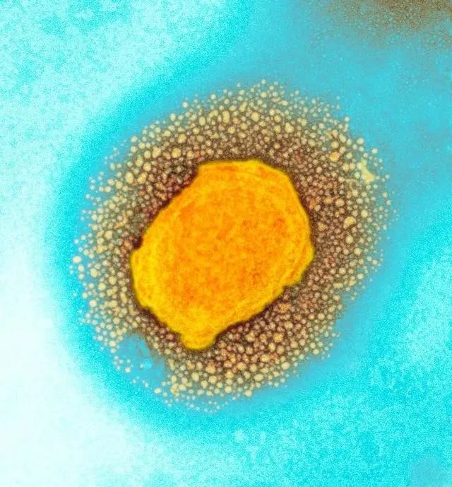 病毒基因测序最新结果公布!已有国家要求“猴痘病例隔离21天”!休闲区蓝鸢梦想 - Www.slyday.coM 病毒基因测序最新结果公布!已有国家要求“猴痘病例隔离21天”!休闲区蓝鸢梦想 - Www.slyday.coM