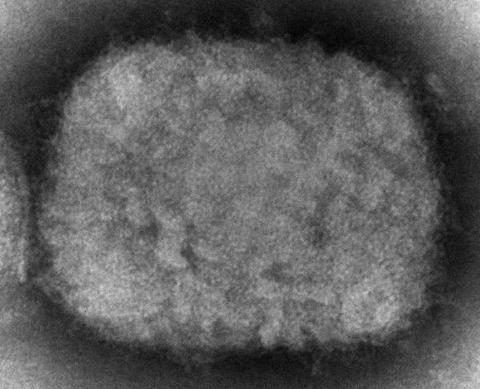 电子显微镜图像显示的猴痘病毒（资料图）