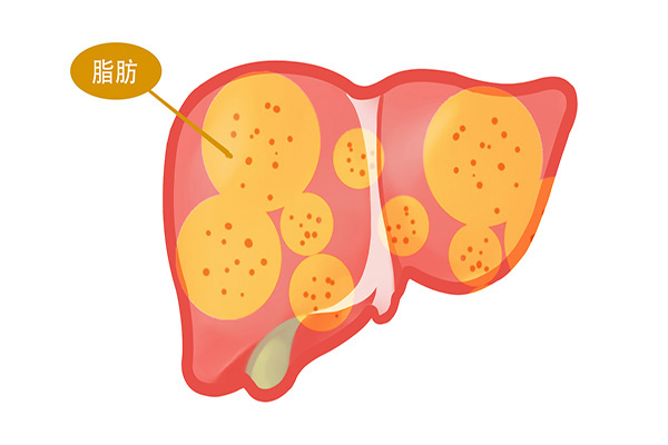 晚上不吃饭,真的能减肥吗?女子尝试一个月,不妨看看她的变化休闲区蓝鸢梦想 - Www.slyday.coM 晚上不吃饭,真的能减肥吗?女子尝试一个月,不妨看看她的变化休闲区蓝鸢梦想 - Www.slyday.coM