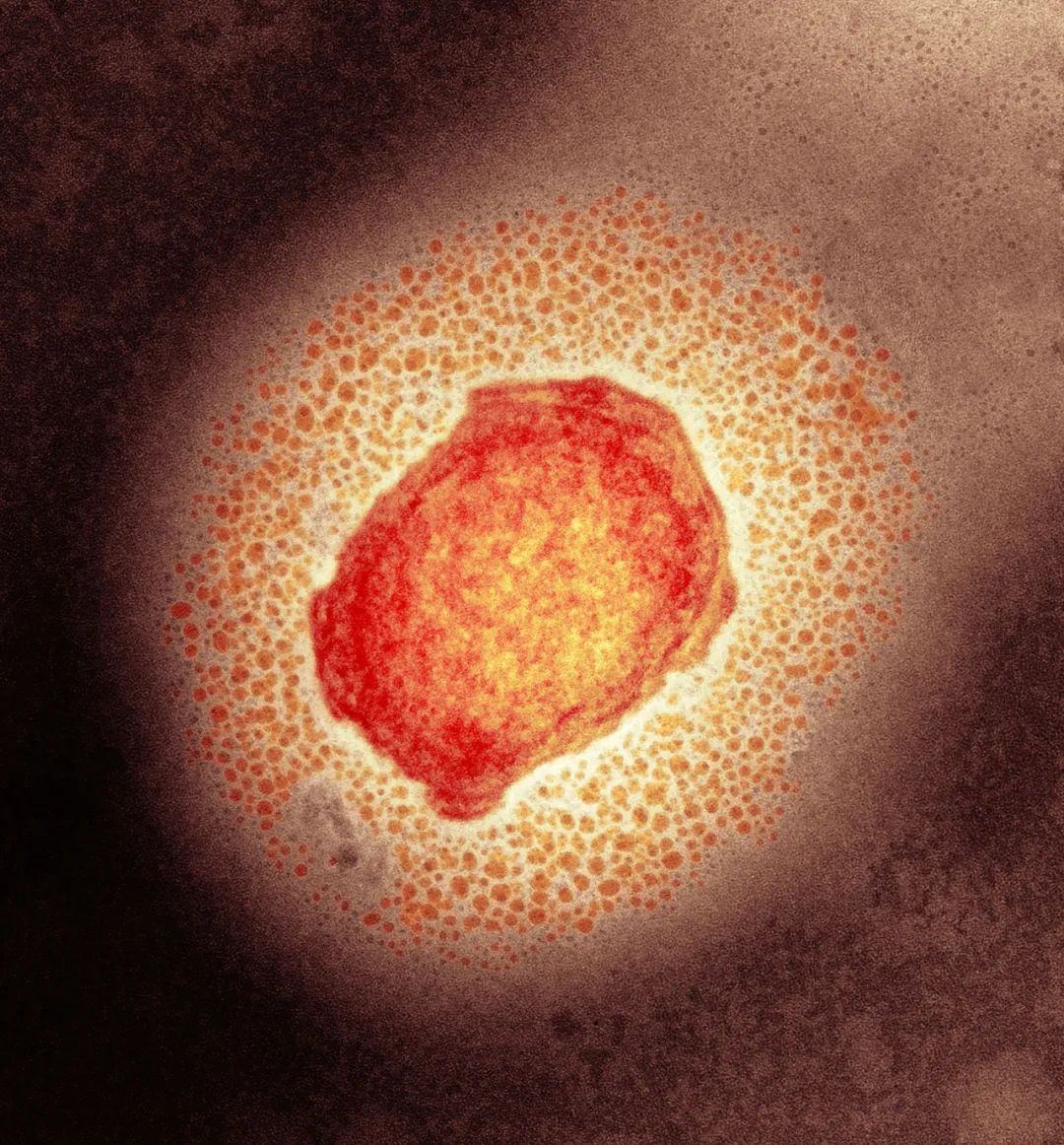 ▲彩色透射电子显微镜（TEM）下的猴痘病毒。图/IC photo