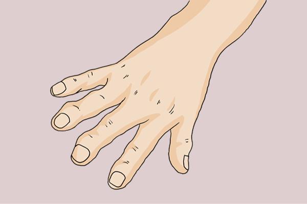 太阳能热水器爆裂,6岁男孩全身大面积烫伤,多次与死神交手休闲区蓝鸢梦想 - Www.slyday.coM 太阳能热水器爆裂,6岁男孩全身大面积烫伤,多次与死神交手休闲区蓝鸢梦想 - Www.slyday.coM