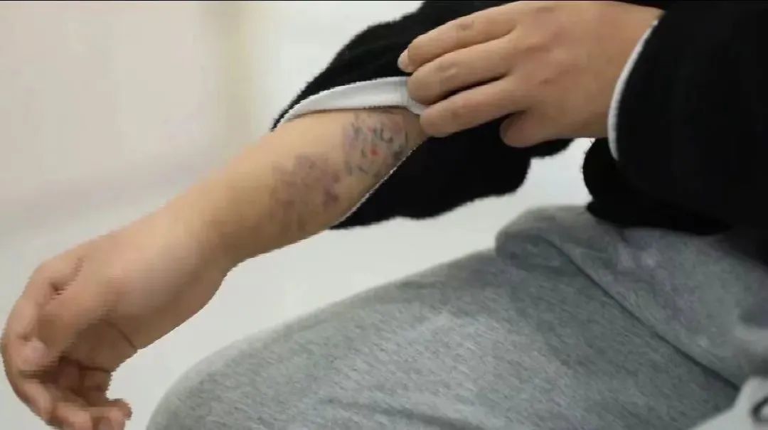 未成年人文身不是家事、私事!网友:12岁时的网名我都受不了,何况文身要一辈子休闲区蓝鸢梦想 - Www.slyday.coM 未成年人文身不是家事、私事!网友:12岁时的网名我都受不了,何况文身要一辈子休闲区蓝鸢梦想 - Www.slyday.coM