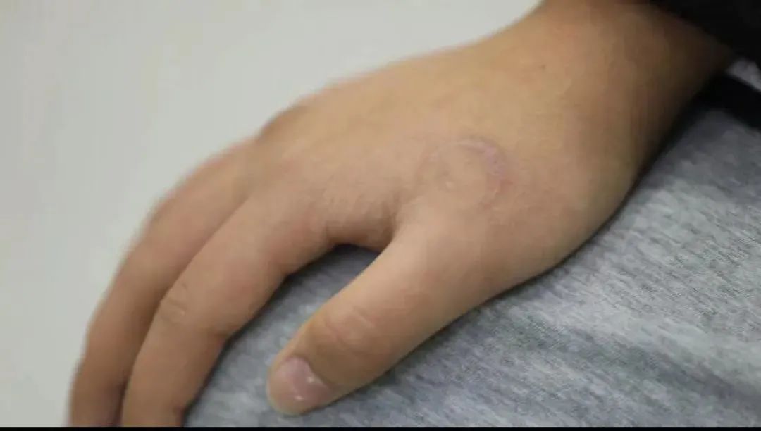 未成年人文身不是家事、私事!网友:12岁时的网名我都受不了,何况文身要一辈子休闲区蓝鸢梦想 - Www.slyday.coM 未成年人文身不是家事、私事!网友:12岁时的网名我都受不了,何况文身要一辈子休闲区蓝鸢梦想 - Www.slyday.coM