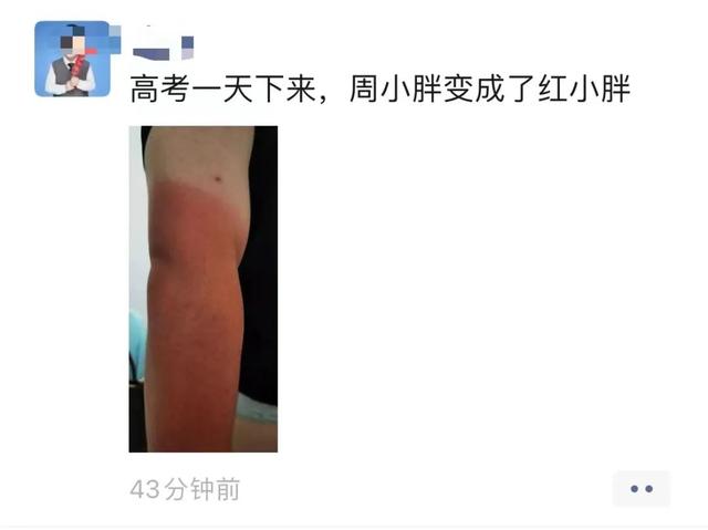 合肥一六八中学考场外,这条胳膊看着让人心疼休闲区蓝鸢梦想 - Www.slyday.coM 合肥一六八中学考场外,这条胳膊看着让人心疼休闲区蓝鸢梦想 - Www.slyday.coM