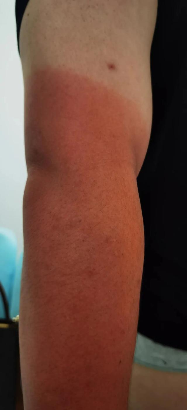 合肥一六八中学考场外,这条胳膊看着让人心疼休闲区蓝鸢梦想 - Www.slyday.coM 合肥一六八中学考场外,这条胳膊看着让人心疼休闲区蓝鸢梦想 - Www.slyday.coM