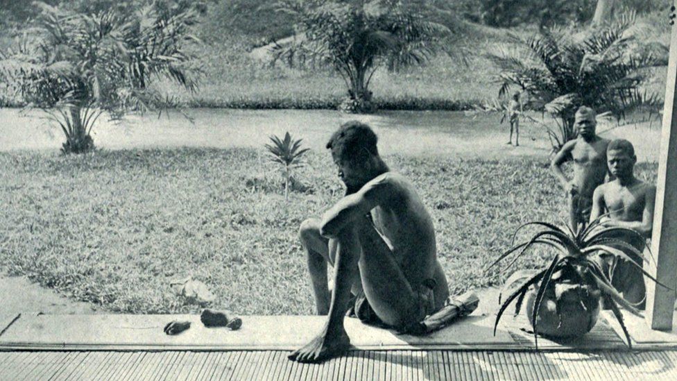 “刚果自由国”时期一名遭比利时殖民者砍手的原住民 图自外媒