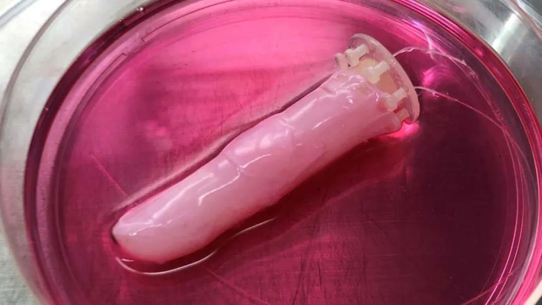 如何让蚊子不再咬人?这是我见过最损的一招!休闲区蓝鸢梦想 - Www.slyday.coM 如何让蚊子不再咬人?这是我见过最损的一招!休闲区蓝鸢梦想 - Www.slyday.coM