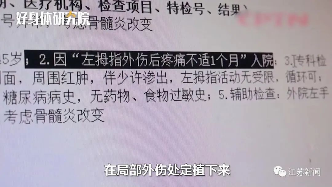 男子被狗咬伤手指,1个月后指骨竟被“吃空”!休闲区蓝鸢梦想 - Www.slyday.coM 男子被狗咬伤手指,1个月后指骨竟被“吃空”!休闲区蓝鸢梦想 - Www.slyday.coM
