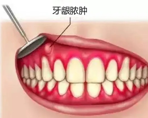 小家问医休闲区蓝鸢梦想 - Www.slyday.coM 小家问医休闲区蓝鸢梦想 - Www.slyday.coM