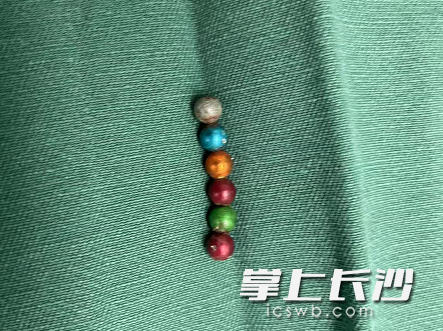 又是它!长沙5岁男童误食7颗磁力珠导致肠穿孔休闲区蓝鸢梦想 - Www.slyday.coM 又是它!长沙5岁男童误食7颗磁力珠导致肠穿孔休闲区蓝鸢梦想 - Www.slyday.coM