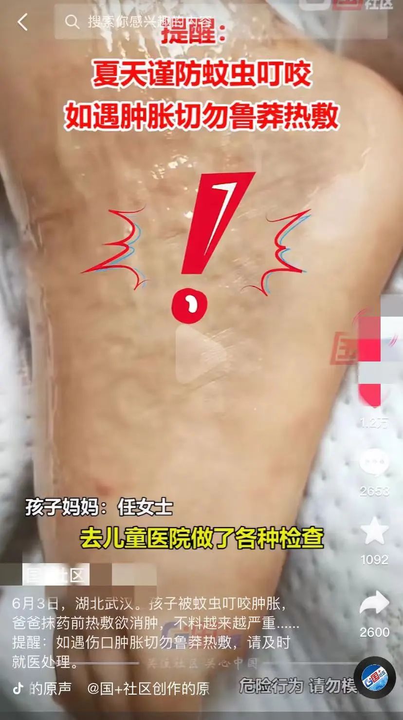 宝宝被蚊虫叮咬后紧急送医,只因爸爸做错了一件事!休闲区蓝鸢梦想 - Www.slyday.coM 宝宝被蚊虫叮咬后紧急送医,只因爸爸做错了一件事!休闲区蓝鸢梦想 - Www.slyday.coM