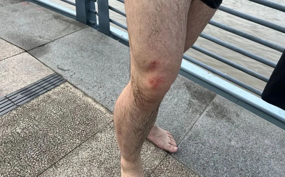 一件被鲜血染红的警服!女儿一句“爸爸是不是要死了”让妻子再也绷不住……休闲区蓝鸢梦想 - Www.slyday.coM 一件被鲜血染红的警服!女儿一句“爸爸是不是要死了”让妻子再也绷不住……休闲区蓝鸢梦想 - Www.slyday.coM