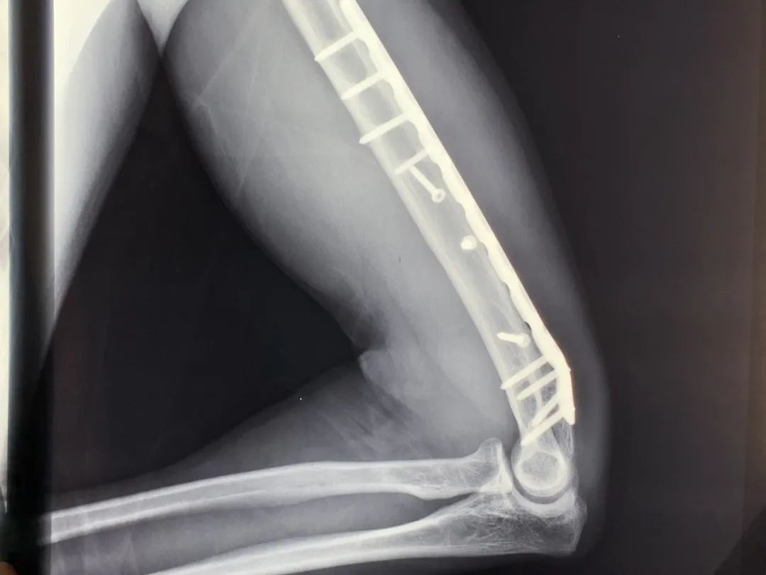 一件被鲜血染红的警服!女儿一句“爸爸是不是要死了”让妻子再也绷不住……休闲区蓝鸢梦想 - Www.slyday.coM 一件被鲜血染红的警服!女儿一句“爸爸是不是要死了”让妻子再也绷不住……休闲区蓝鸢梦想 - Www.slyday.coM