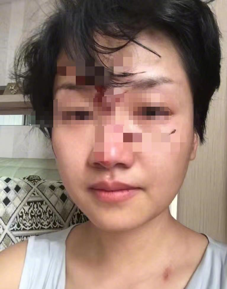 副教授被妻子举报“家暴”,曾主持知名相亲节目休闲区蓝鸢梦想 - Www.slyday.coM 副教授被妻子举报“家暴”,曾主持知名相亲节目休闲区蓝鸢梦想 - Www.slyday.coM