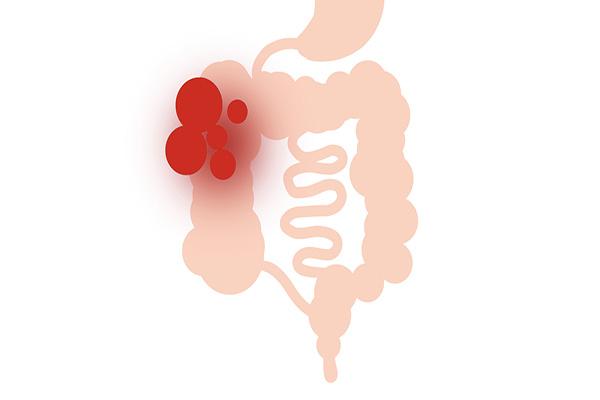 哈佛研究发现:熬夜可以“保命”?熬夜猝死的真相是什么?休闲区蓝鸢梦想 - Www.slyday.coM 哈佛研究发现:熬夜可以“保命”?熬夜猝死的真相是什么?休闲区蓝鸢梦想 - Www.slyday.coM