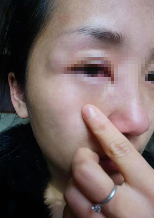 副教授被妻子举报“家暴”,曾主持知名相亲节目休闲区蓝鸢梦想 - Www.slyday.coM 副教授被妻子举报“家暴”,曾主持知名相亲节目休闲区蓝鸢梦想 - Www.slyday.coM