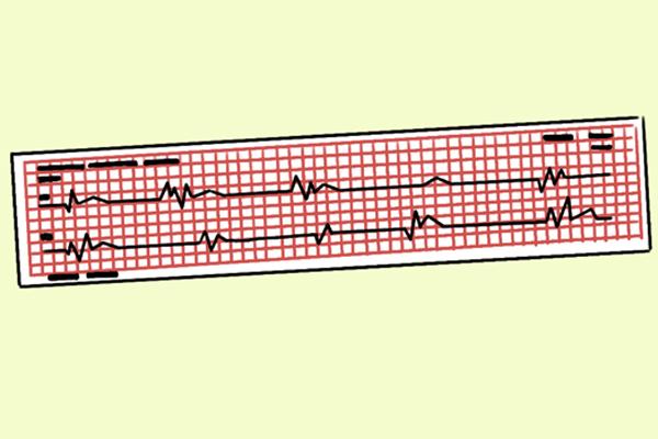 有些问题并不是病,总有人被忽悠,把衰老当成病过度治疗休闲区蓝鸢梦想 - Www.slyday.coM 有些问题并不是病,总有人被忽悠,把衰老当成病过度治疗休闲区蓝鸢梦想 - Www.slyday.coM