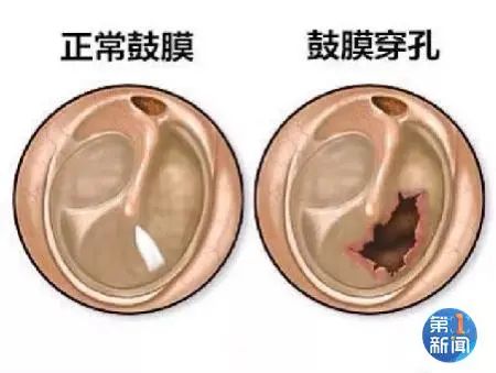 最担心的事发生了!男子打蚊子,一个巴掌下去…休闲区蓝鸢梦想 - Www.slyday.coM 最担心的事发生了!男子打蚊子,一个巴掌下去…休闲区蓝鸢梦想 - Www.slyday.coM