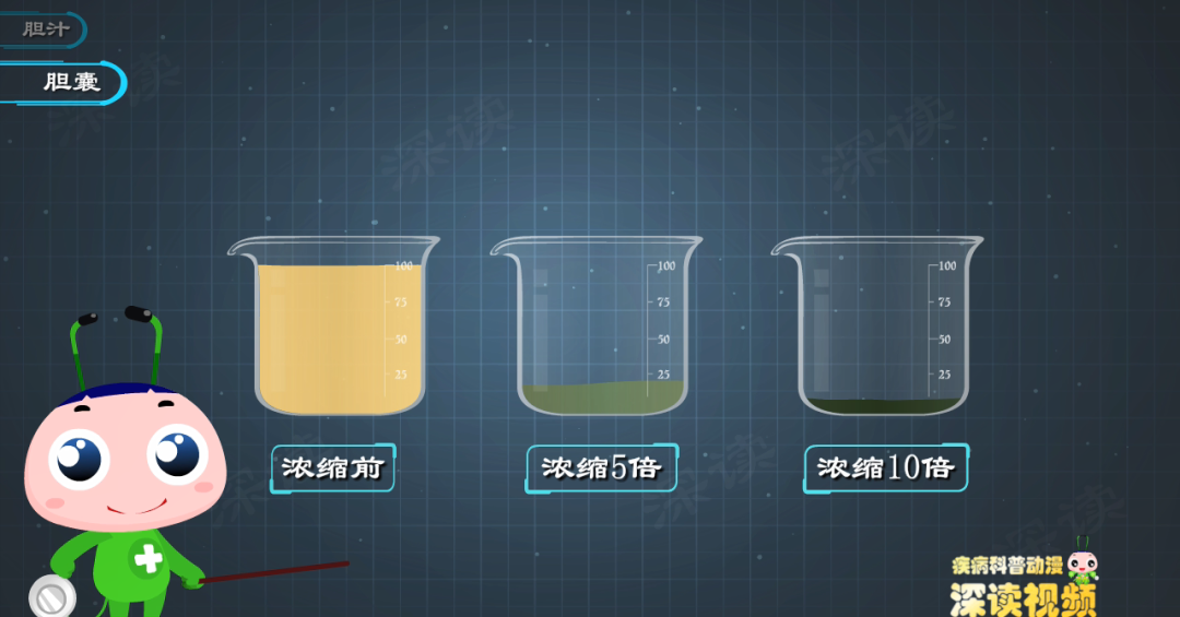 厌油恶心、腹泻、没胃口,快来看看你的胆汁是不是被胆管结石堵住了?休闲区蓝鸢梦想 - Www.slyday.coM 厌油恶心、腹泻、没胃口,快来看看你的胆汁是不是被胆管结石堵住了?休闲区蓝鸢梦想 - Www.slyday.coM