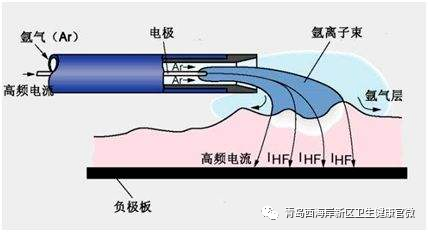 技术上水平西海岸新区人民医院巧解气管险窒息难题!(图4) 技术上水平西海岸新区人民医院巧解气管险窒息难题!(图4)