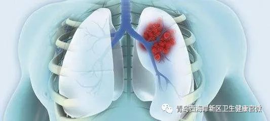 技术上水平西海岸新区人民医院巧解气管险窒息难题!(图1) 技术上水平西海岸新区人民医院巧解气管险窒息难题!(图1)