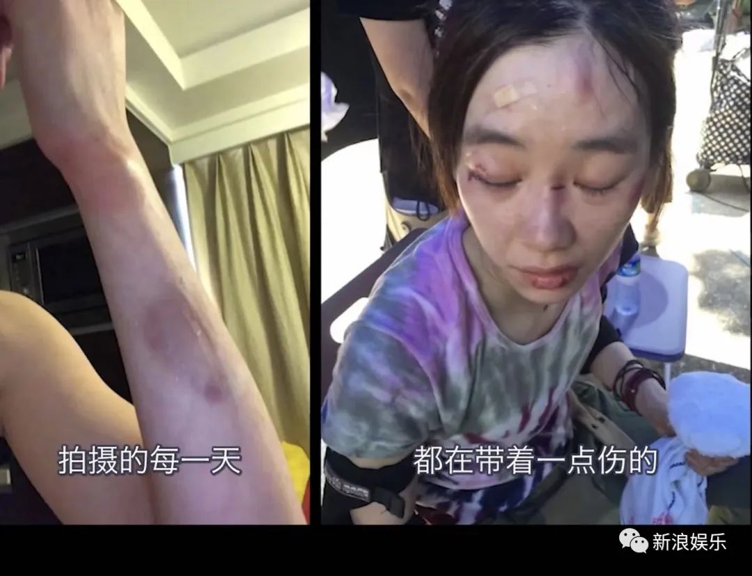 她打了多少“内娱顶流”的脸休闲区蓝鸢梦想 - Www.slyday.coM 她打了多少“内娱顶流”的脸休闲区蓝鸢梦想 - Www.slyday.coM