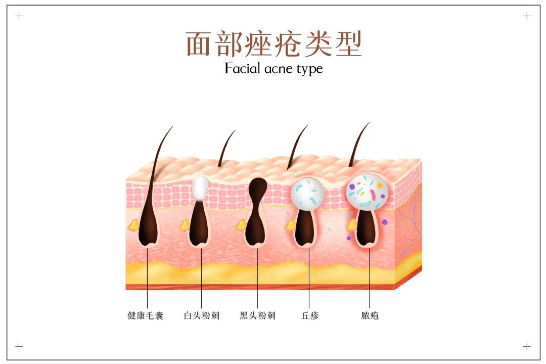 让人上瘾的“糖”,致癌、伤心、伤脑!正确控糖,你该这样做休闲区蓝鸢梦想 - Www.slyday.coM 让人上瘾的“糖”,致癌、伤心、伤脑!正确控糖,你该这样做休闲区蓝鸢梦想 - Www.slyday.coM