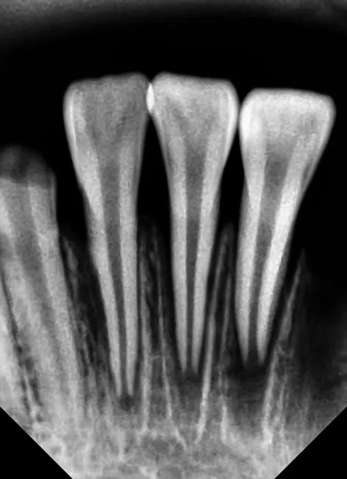 【遭遇】固原8岁女孩被电动车撞倒摔断牙齿!对方竟扬长而去…休闲区蓝鸢梦想 - Www.slyday.coM 【遭遇】固原8岁女孩被电动车撞倒摔断牙齿!对方竟扬长而去…休闲区蓝鸢梦想 - Www.slyday.coM