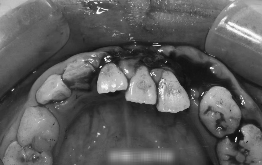 【遭遇】固原8岁女孩被电动车撞倒摔断牙齿!对方竟扬长而去…休闲区蓝鸢梦想 - Www.slyday.coM 【遭遇】固原8岁女孩被电动车撞倒摔断牙齿!对方竟扬长而去…休闲区蓝鸢梦想 - Www.slyday.coM