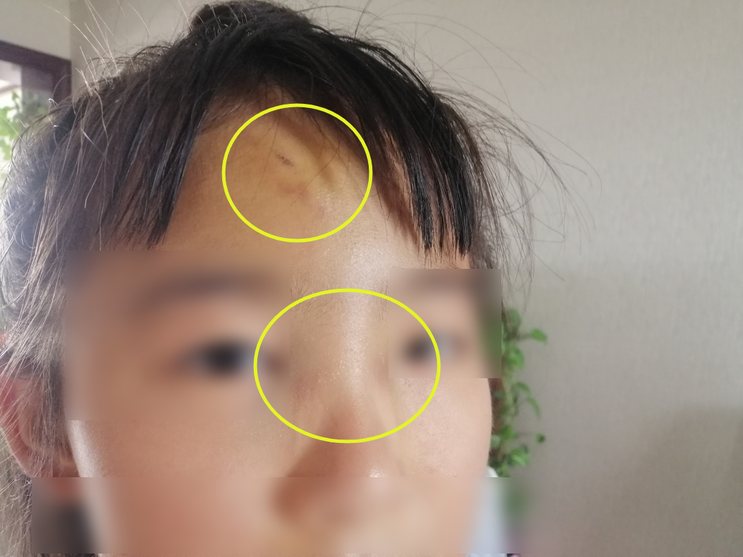 【遭遇】固原8岁女孩被电动车撞倒摔断牙齿!对方竟扬长而去…休闲区蓝鸢梦想 - Www.slyday.coM 【遭遇】固原8岁女孩被电动车撞倒摔断牙齿!对方竟扬长而去…休闲区蓝鸢梦想 - Www.slyday.coM