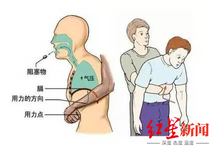 两岁男童糖果卡喉“快不行了”!多亏妈妈会“海姆立克急救法”休闲区蓝鸢梦想 - Www.slyday.coM 两岁男童糖果卡喉“快不行了”!多亏妈妈会“海姆立克急救法”休闲区蓝鸢梦想 - Www.slyday.coM