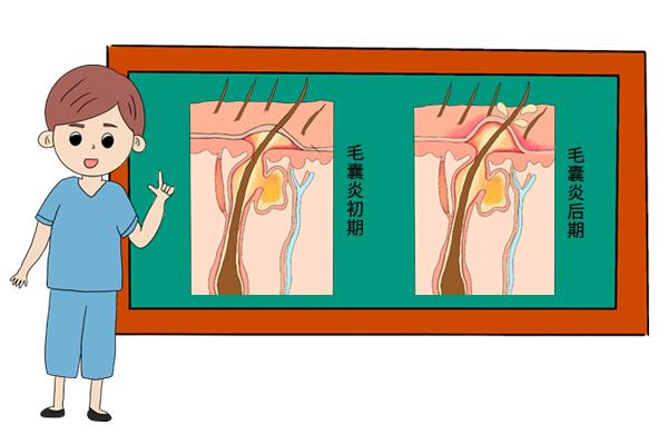 男性的内裤应该天天换吗?不喜欢穿内裤的人,3个好处向你走来休闲区蓝鸢梦想 - Www.slyday.coM 男性的内裤应该天天换吗?不喜欢穿内裤的人,3个好处向你走来休闲区蓝鸢梦想 - Www.slyday.coM