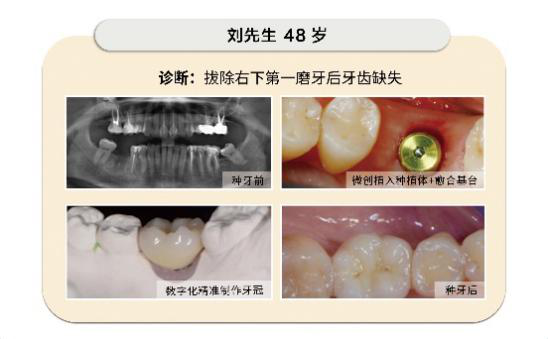 汽油车报废有补贴吗