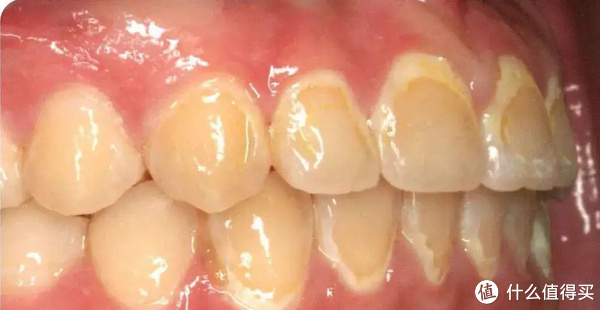 每天除了刷牙,多加一个动作,口腔健康更上一层楼休闲区蓝鸢梦想 - Www.slyday.coM 每天除了刷牙,多加一个动作,口腔健康更上一层楼休闲区蓝鸢梦想 - Www.slyday.coM