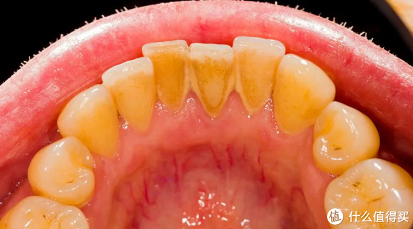 每天除了刷牙,多加一个动作,口腔健康更上一层楼休闲区蓝鸢梦想 - Www.slyday.coM 每天除了刷牙,多加一个动作,口腔健康更上一层楼休闲区蓝鸢梦想 - Www.slyday.coM