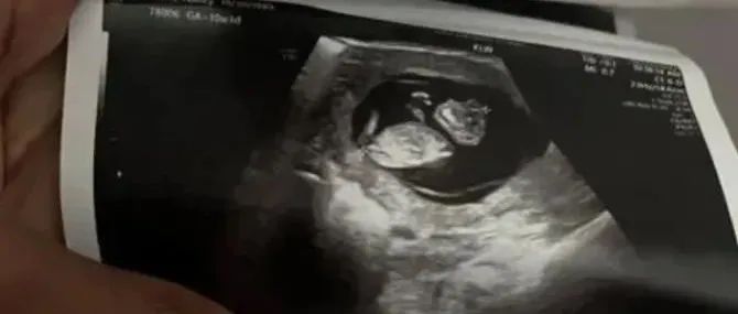 堕胎后身体调理 意外怀孕怎么办