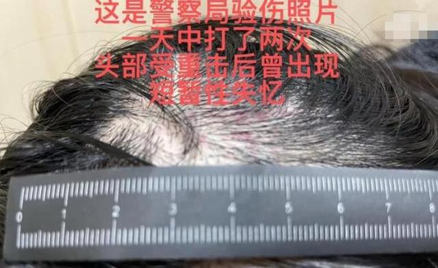 演员王东被妻子控诉家暴!女方头部受伤导致失忆,本人回应解脱了休闲区蓝鸢梦想 - Www.slyday.coM 演员王东被妻子控诉家暴!女方头部受伤导致失忆,本人回应解脱了休闲区蓝鸢梦想 - Www.slyday.coM