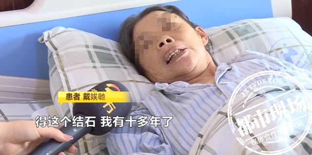 7旬女子患结石病10多年,自行吃药不痛就不去医院,左肾长满结石休闲区蓝鸢梦想 - Www.slyday.coM 7旬女子患结石病10多年,自行吃药不痛就不去医院,左肾长满结石休闲区蓝鸢梦想 - Www.slyday.coM