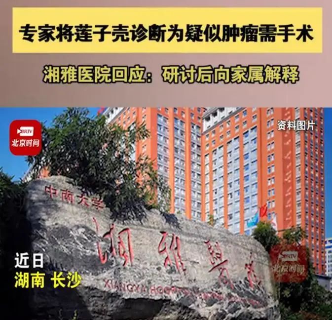 300元专家号,居然将莲子壳诊断为肿瘤?涉事医院回应休闲区蓝鸢梦想 - Www.slyday.coM 300元专家号,居然将莲子壳诊断为肿瘤?涉事医院回应休闲区蓝鸢梦想 - Www.slyday.coM