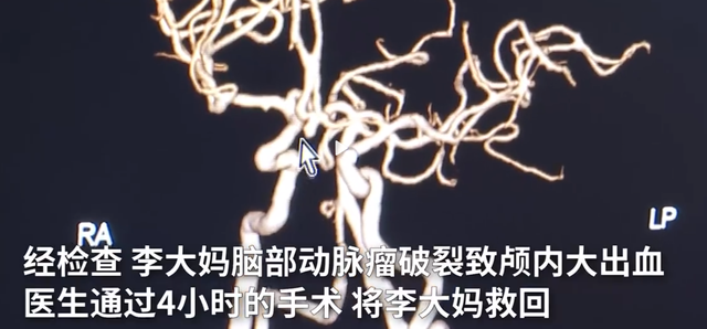 六旬女子紧急送医!家人听信偏方,让她8岁开始抽烟休闲区蓝鸢梦想 - Www.slyday.coM 六旬女子紧急送医!家人听信偏方,让她8岁开始抽烟休闲区蓝鸢梦想 - Www.slyday.coM