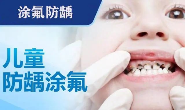 儿童涂氟防蛀牙,真的很有必要!休闲区蓝鸢梦想 - Www.slyday.coM 儿童涂氟防蛀牙,真的很有必要!休闲区蓝鸢梦想 - Www.slyday.coM