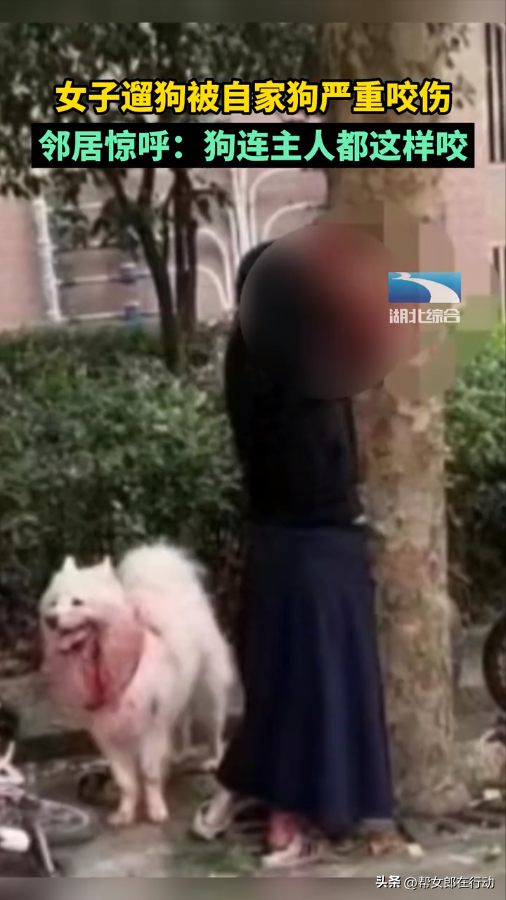 遛狗被自家狗严重咬伤 邻居惊呼:狗连主人都这样咬休闲区蓝鸢梦想 - Www.slyday.coM 遛狗被自家狗严重咬伤 邻居惊呼:狗连主人都这样咬休闲区蓝鸢梦想 - Www.slyday.coM