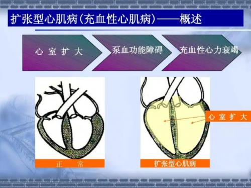戴着人工心脏上脱口秀大会——王十七的充电人生休闲区蓝鸢梦想 - Www.slyday.coM 戴着人工心脏上脱口秀大会——王十七的充电人生休闲区蓝鸢梦想 - Www.slyday.coM