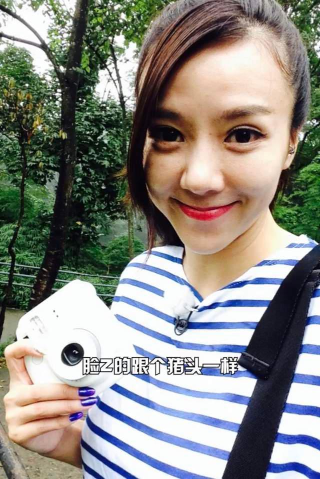 40岁女星周韦彤大方承认整容,脸肿等后遗症多,直言动脸毁了人生休闲区蓝鸢梦想 - Www.slyday.coM 40岁女星周韦彤大方承认整容,脸肿等后遗症多,直言动脸毁了人生休闲区蓝鸢梦想 - Www.slyday.coM