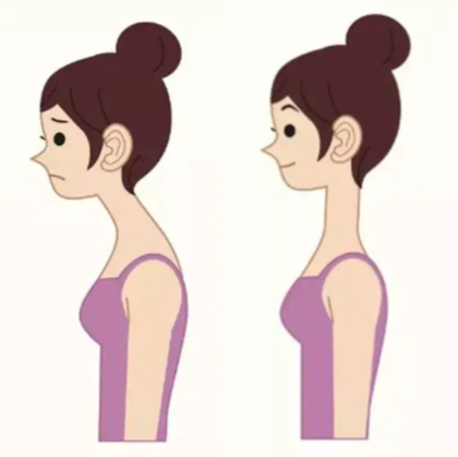 教你几招,告别含胸驼背休闲区蓝鸢梦想 - Www.slyday.coM 教你几招,告别含胸驼背休闲区蓝鸢梦想 - Www.slyday.coM