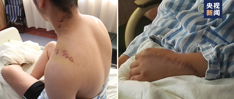 他的警服曾被鲜血染红,小女儿的心愿看哭了休闲区蓝鸢梦想 - Www.slyday.coM 他的警服曾被鲜血染红,小女儿的心愿看哭了休闲区蓝鸢梦想 - Www.slyday.coM