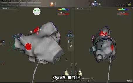 一个月晕倒10多次,原来是心脏出现了这个问题休闲区蓝鸢梦想 - Www.slyday.coM 一个月晕倒10多次,原来是心脏出现了这个问题休闲区蓝鸢梦想 - Www.slyday.coM