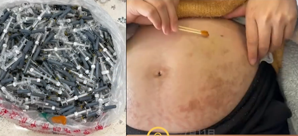 黄体酮真的有必要打吗?产检孕酮低是不是流产几率很大?休闲区蓝鸢梦想 - Www.slyday.coM 黄体酮真的有必要打吗?产检孕酮低是不是流产几率很大?休闲区蓝鸢梦想 - Www.slyday.coM